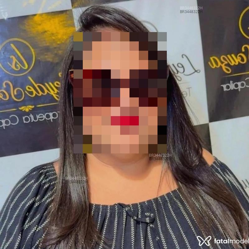 Acompanhante Laninha - Feed