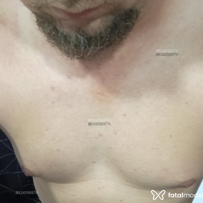 Acompanhante Marcelo - Feed