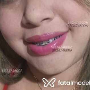 Acompanhante Lauana - Feed