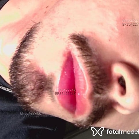 Acompanhante Loirinho - Feed
