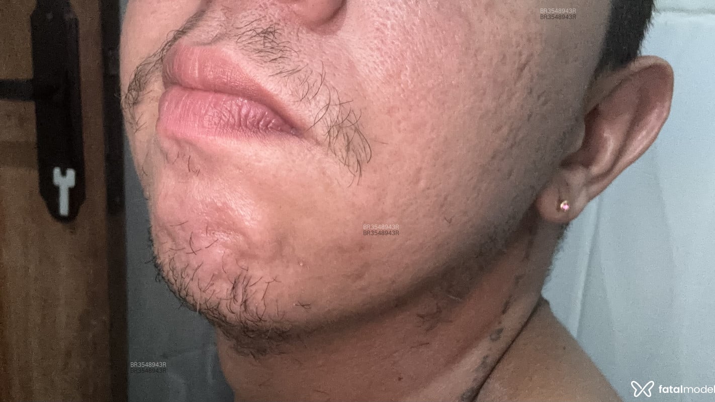 Acompanhante Nanorzinho - Feed