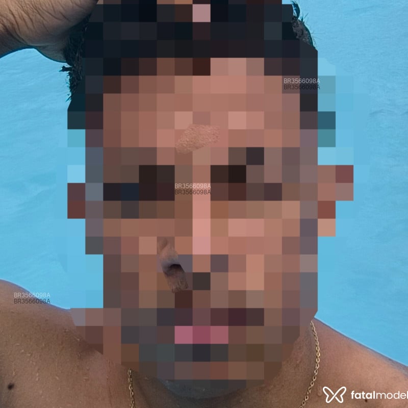 Acompanhante Calaco - Feed