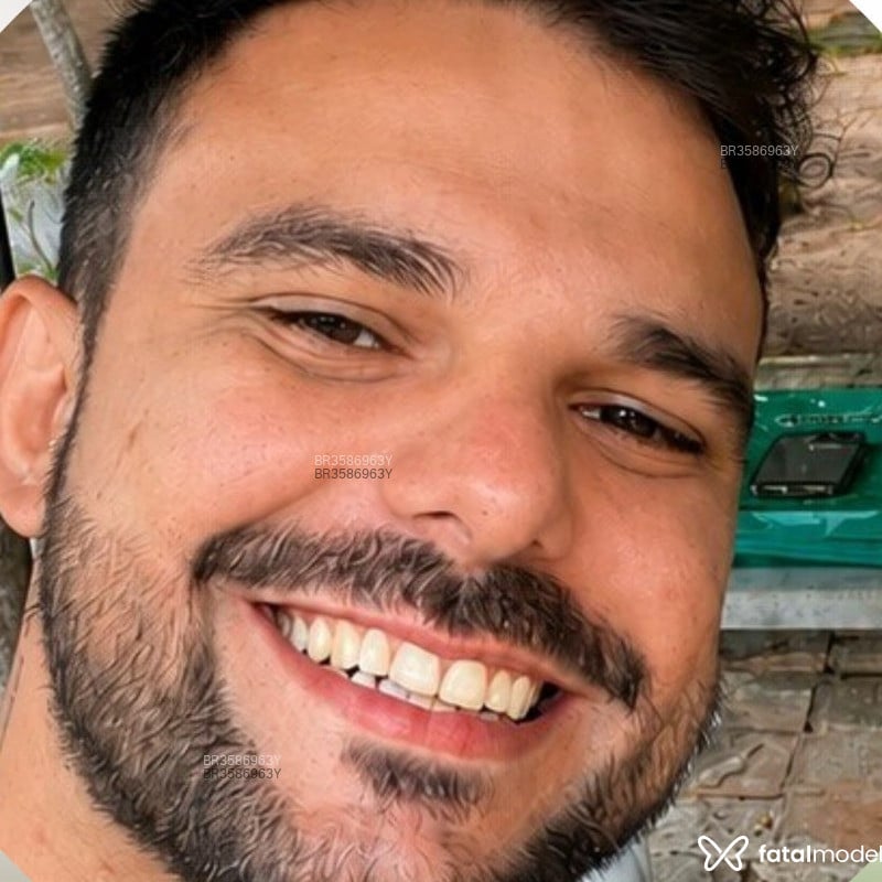 Acompanhante Denis Ricardo - Feed