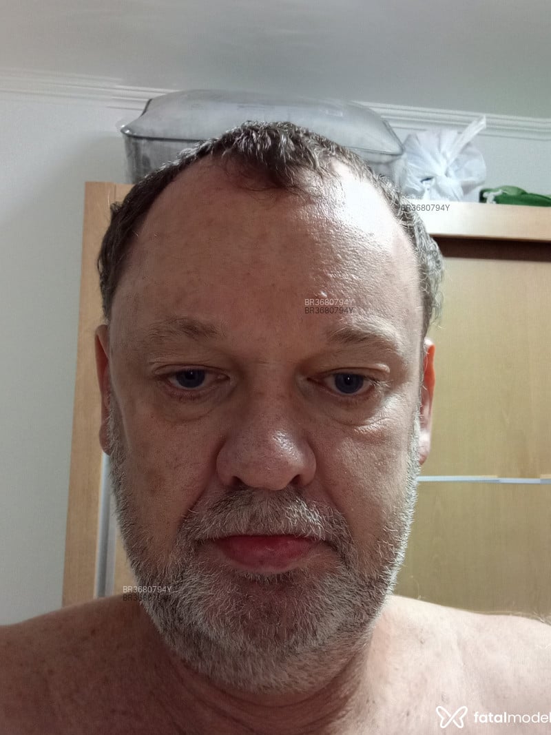 Acompanhante João Carlos - Feed