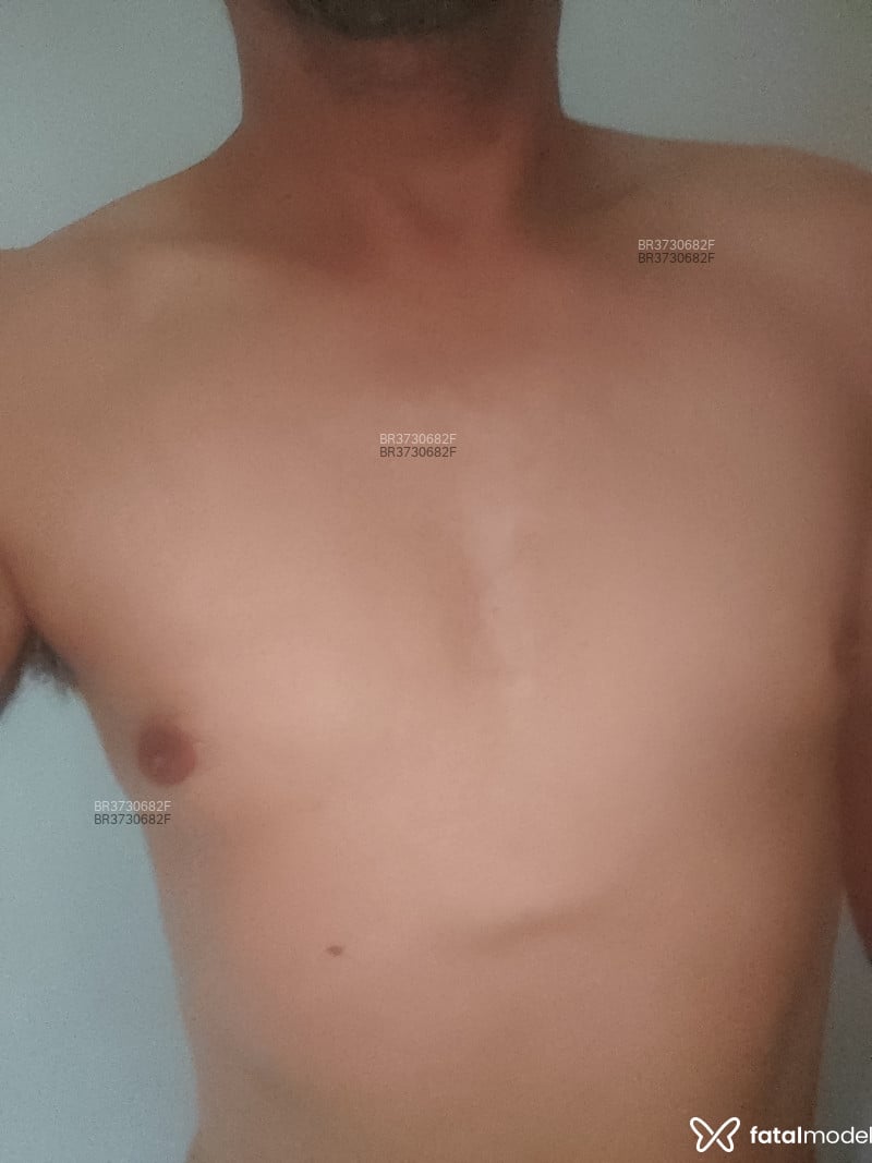 Acompanhante Badlove - Feed
