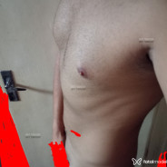 Imagem da acompanhante