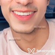 Acompanhante Leozinho - Perfil