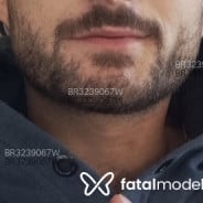 Acompanhante Rmm - Perfil