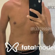 Acompanhante Luís Marcos - Perfil