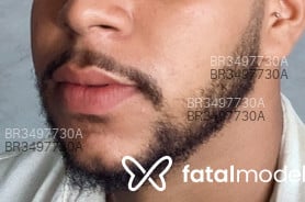 Acompanhante Rodrigues - Perfil