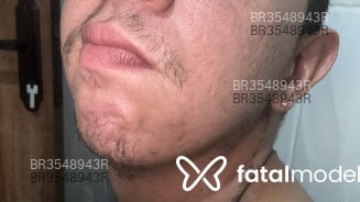 Acompanhante Nanorzinho - Perfil
