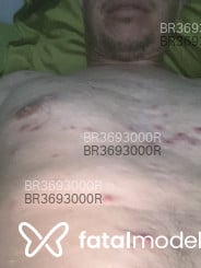 Acompanhante Tiago Cicatriz - Perfil