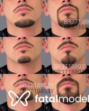 Acompanhante José Antonio - Perfil