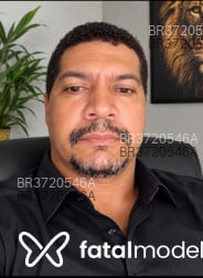 Acompanhante Remove Cabaço - Perfil
