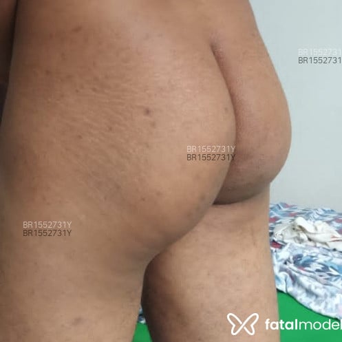 Acompanhante homem morena (o) de olhos castanhos em Divinópolis Acompanhante homem morena (o) de olhos castanhos em Divinópolis - Rodrigo larcerda