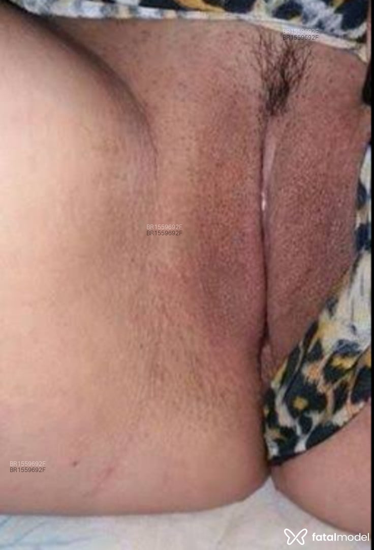 Acompanhante mulher morena (o) de olhos castanhos em João Pessoa Acompanhante mulher morena (o) de olhos castanhos em João Pessoa - Bruna surfistinhaa