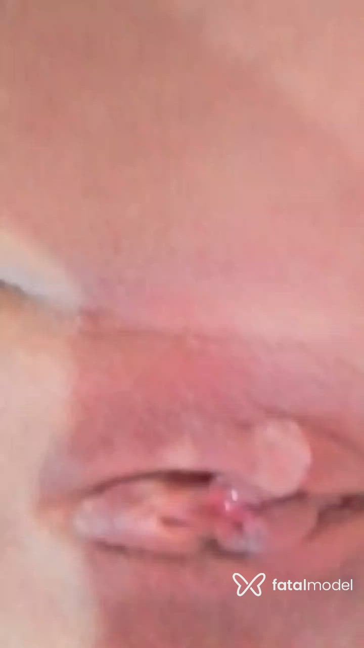 Vídeo 5