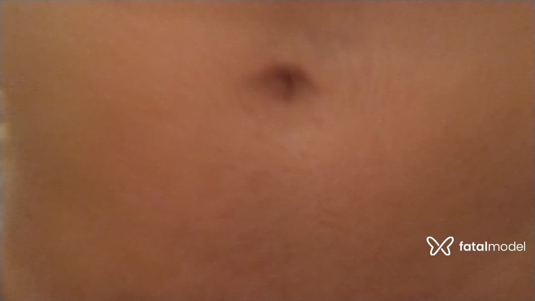 Vídeo 5