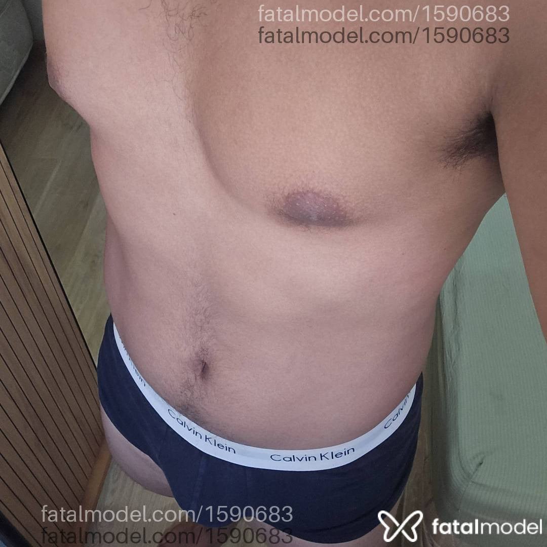 Imagem 1