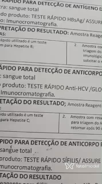 Vídeo 3