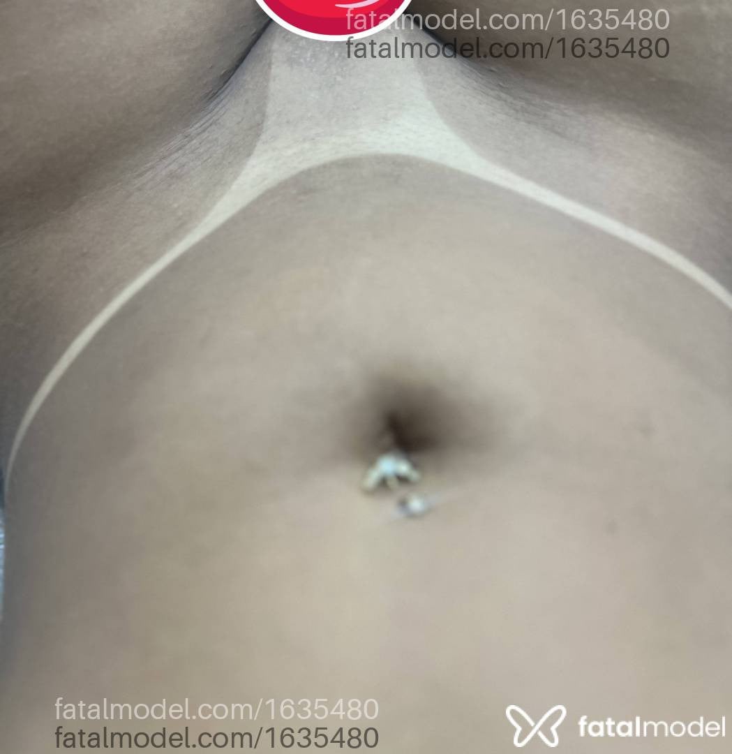 Imagem 10