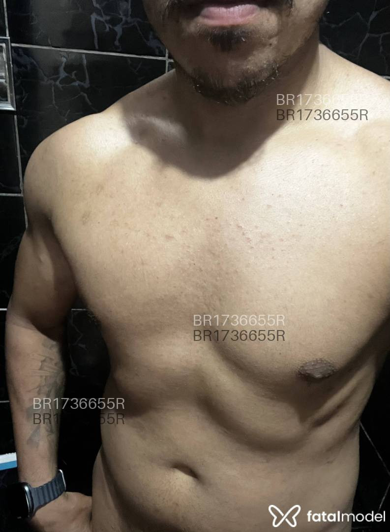 Imagem 3