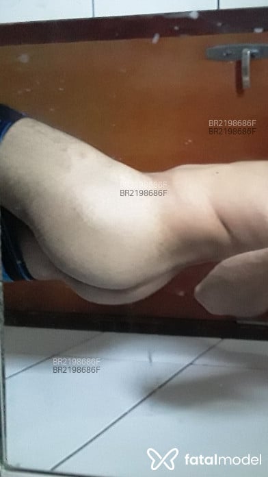 Imagem 2