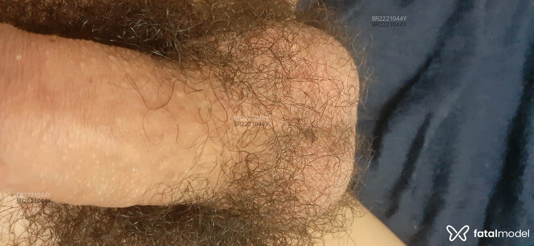 Imagem 8