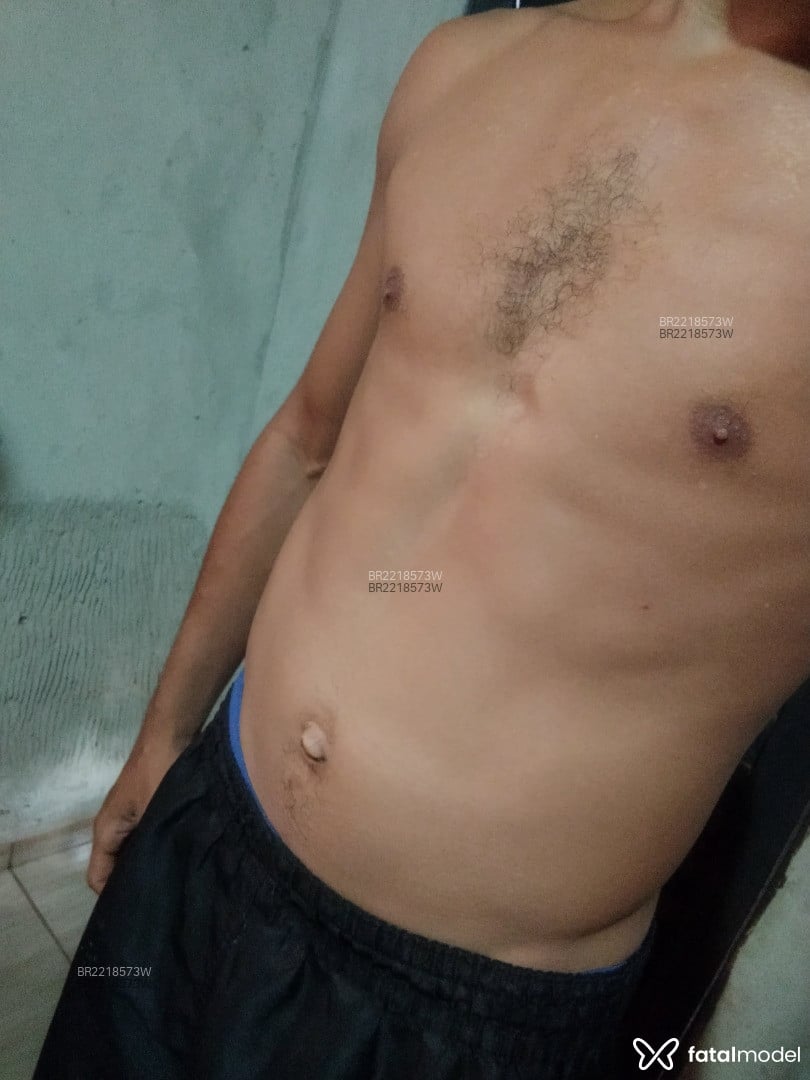 Imagem 3