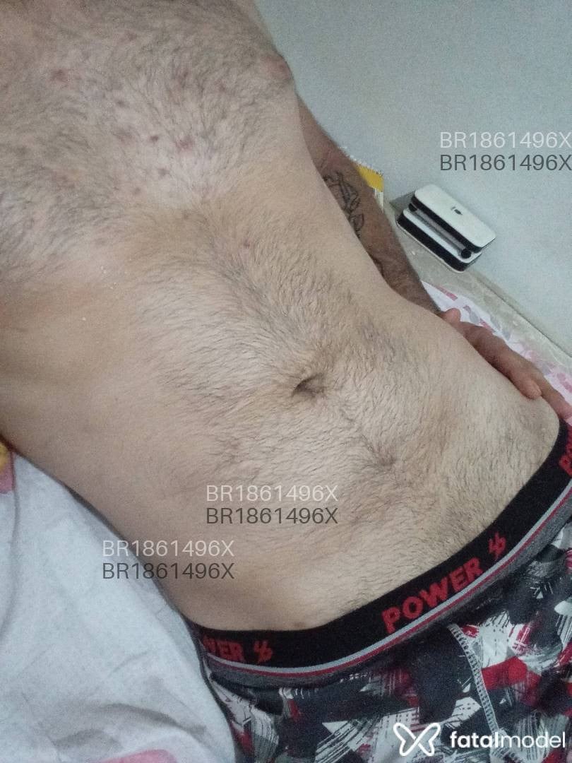 Imagem 3