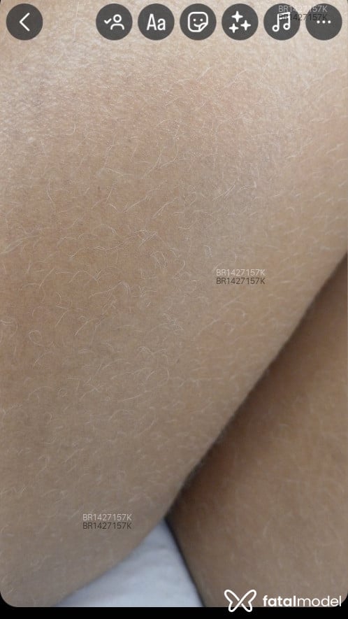 Imagem 6