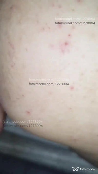 Acompanhante mulher com cabelo colorido de olhos azuis em Criciúma Acompanhante mulher com cabelo colorido de olhos azuis em Criciúma - Suelen