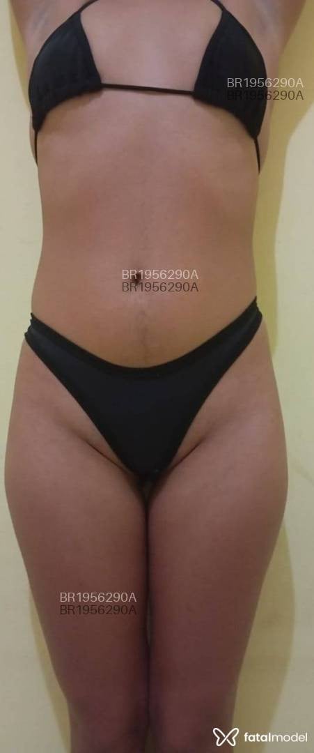Acompanhante mulher morena (o) de olhos mel em Garanhuns Acompanhante mulher morena (o) de olhos mel em Garanhuns - Mel Liz