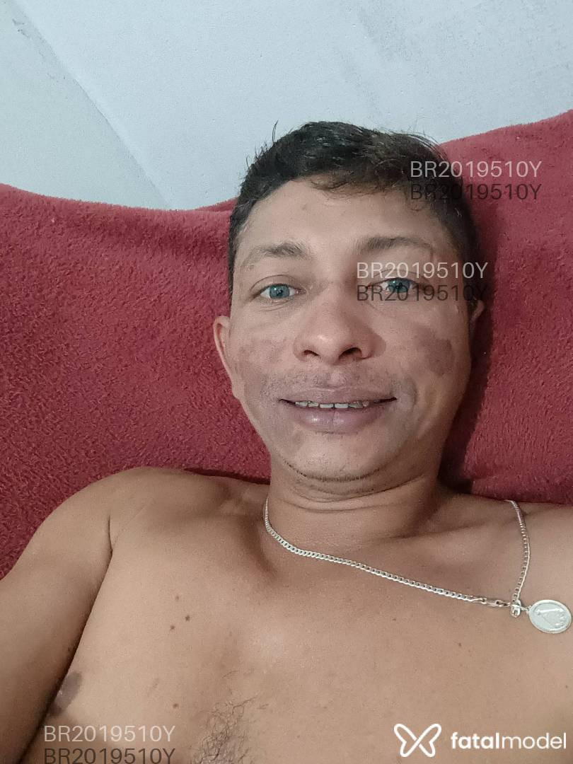Imagem 1
