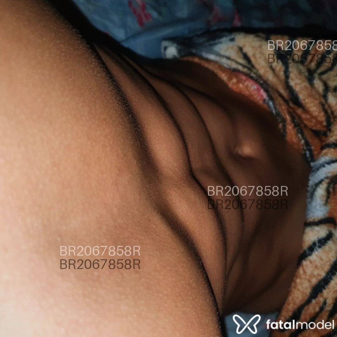 Imagem 12