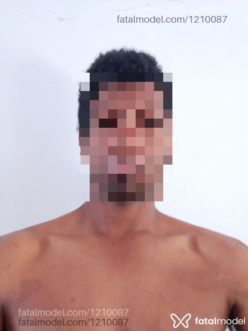 Imagem 1