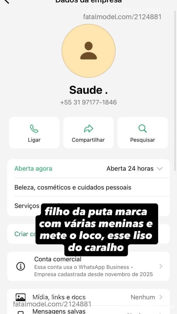 Acompanhante mulher ruiva (o) de olhos castanhos - Melissa