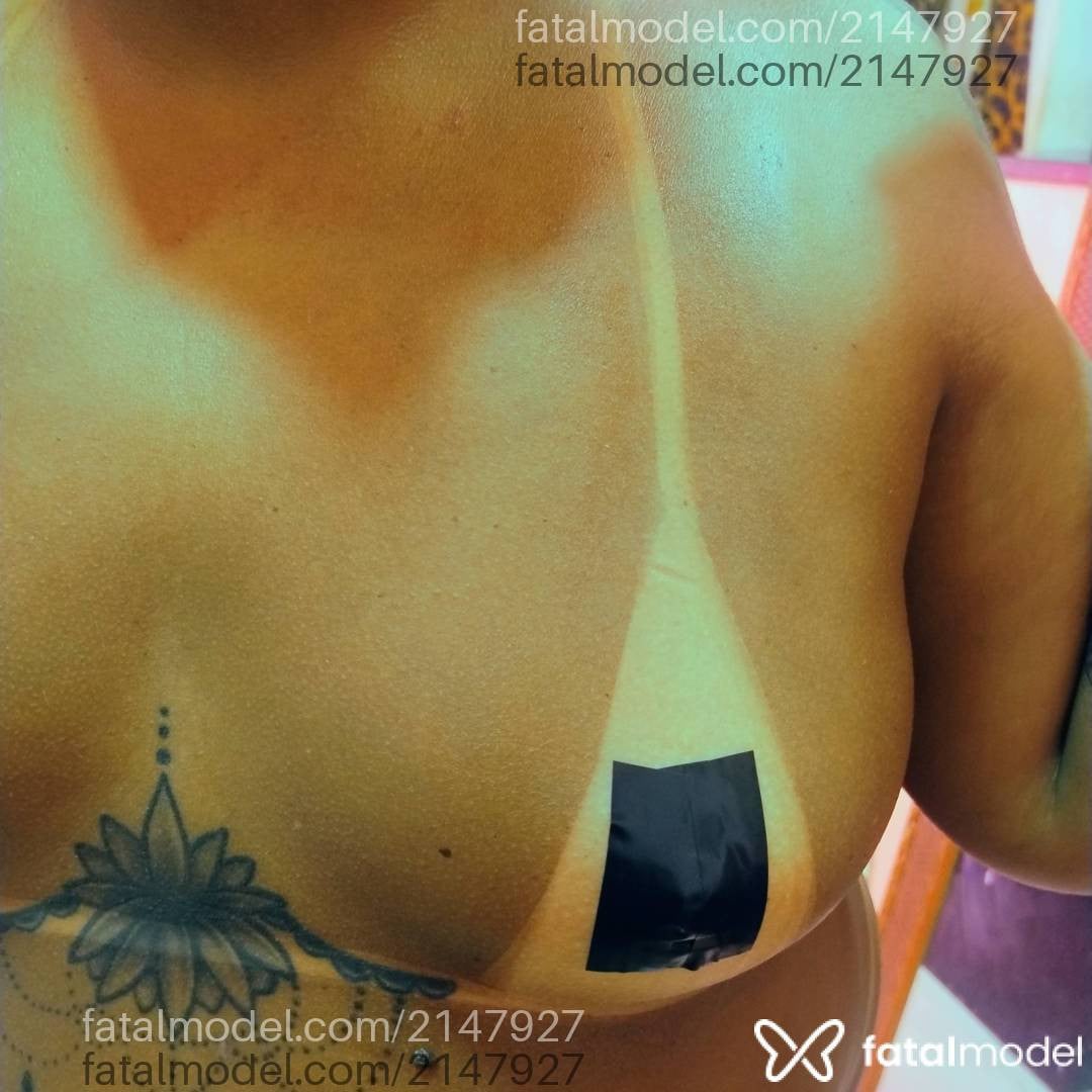 Imagem 7