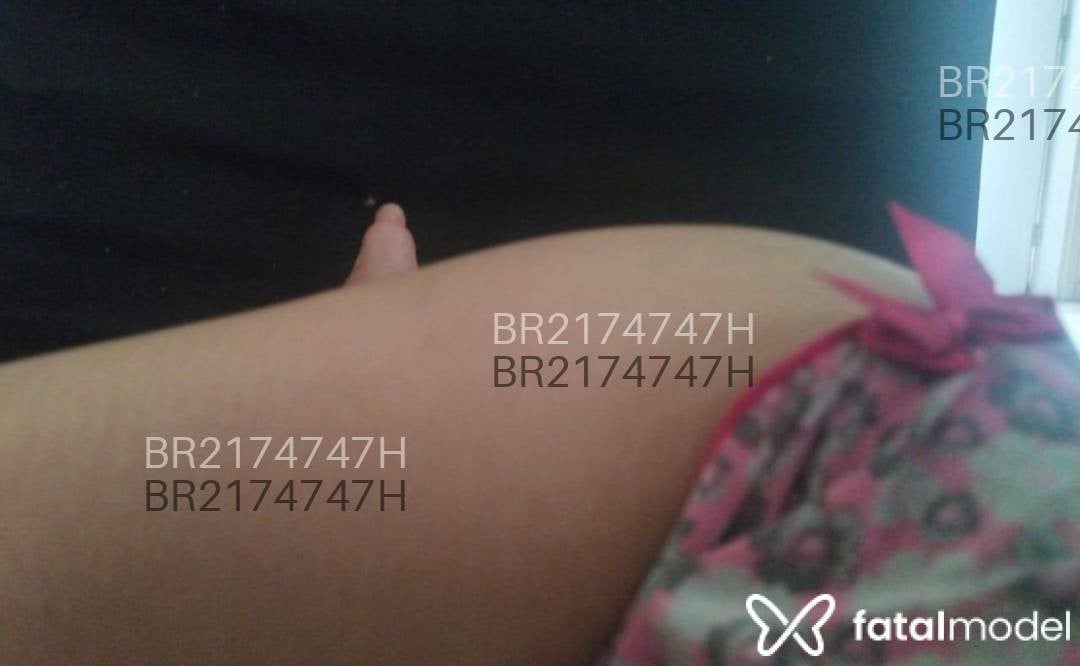 Imagem 4
