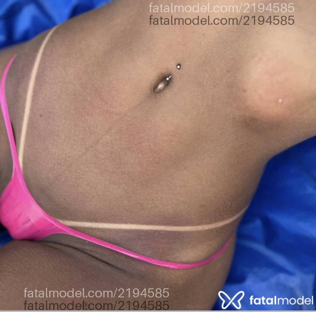 Imagem 4