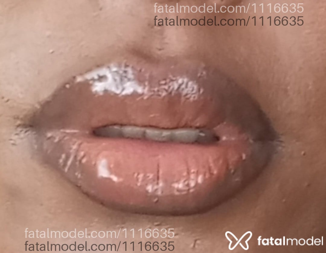 Imagem 4