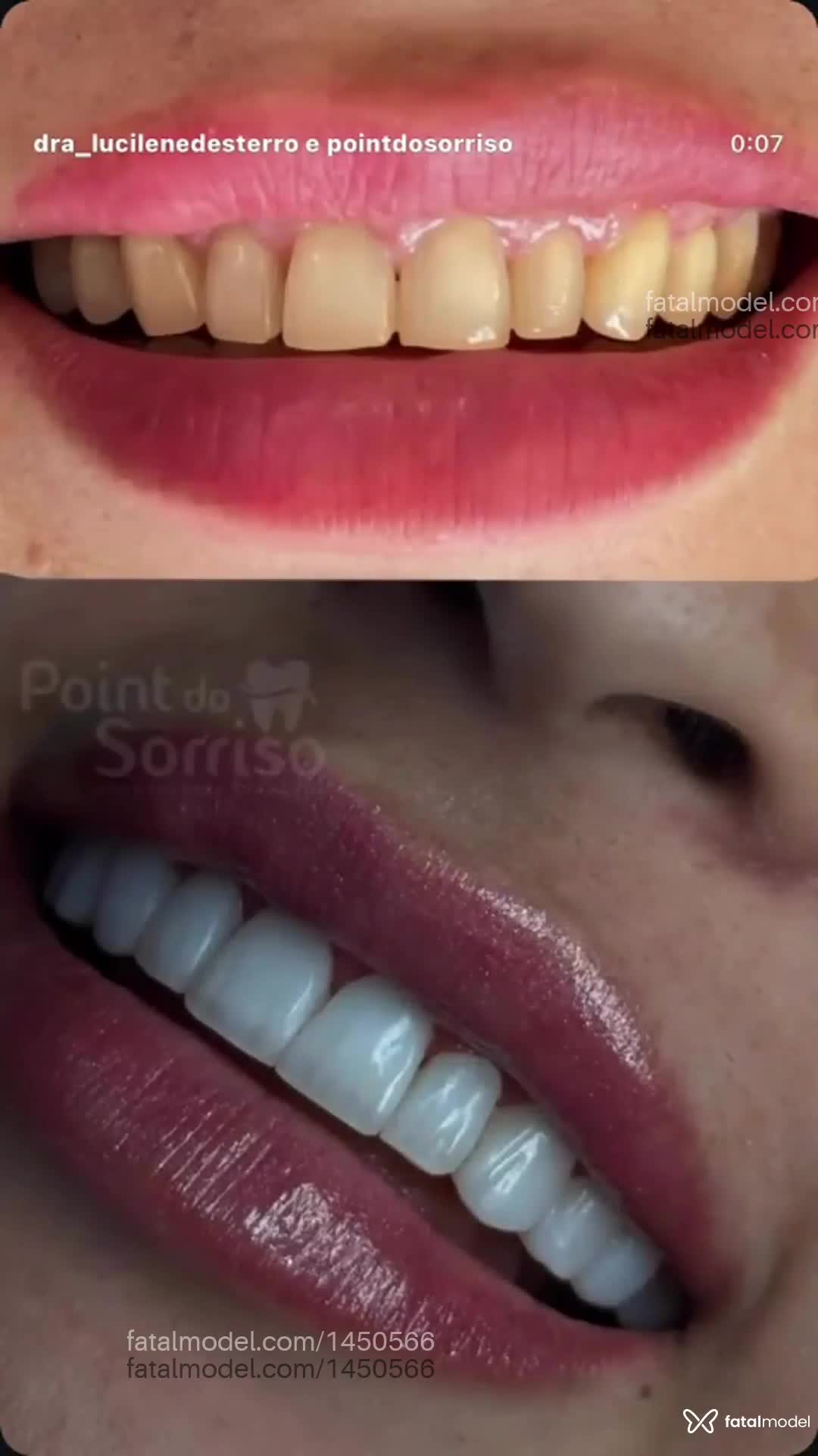 Acompanhante mulher morena (o) de olhos pretos - Sther Campos