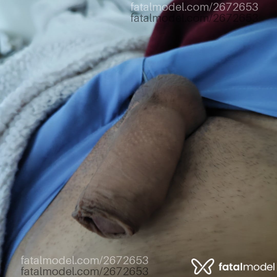 Imagem 2