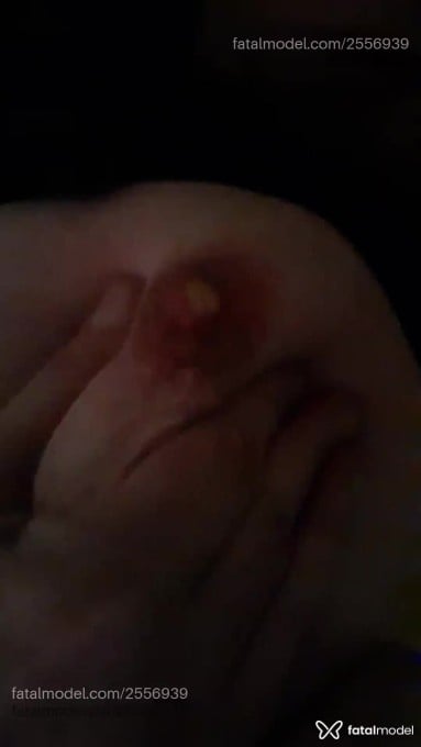Vídeo 2