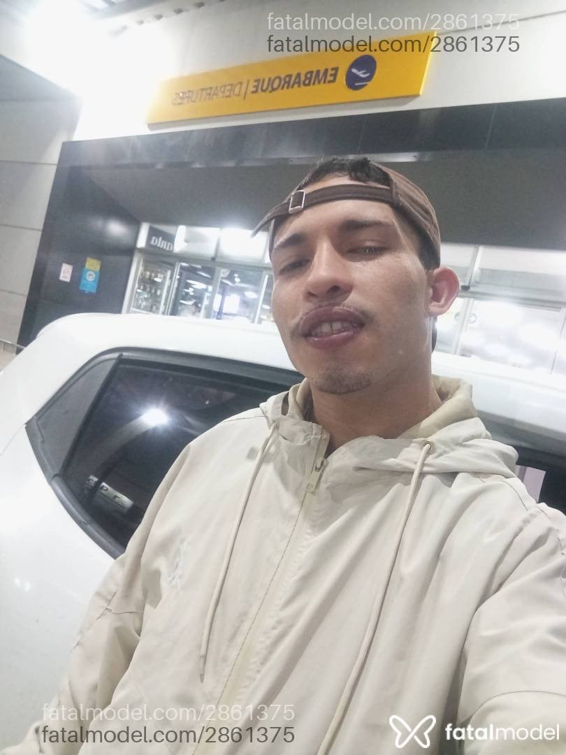 Acompanhante homem morena (o) de olhos pretos em Balneário Camboriú - Conjuntivite