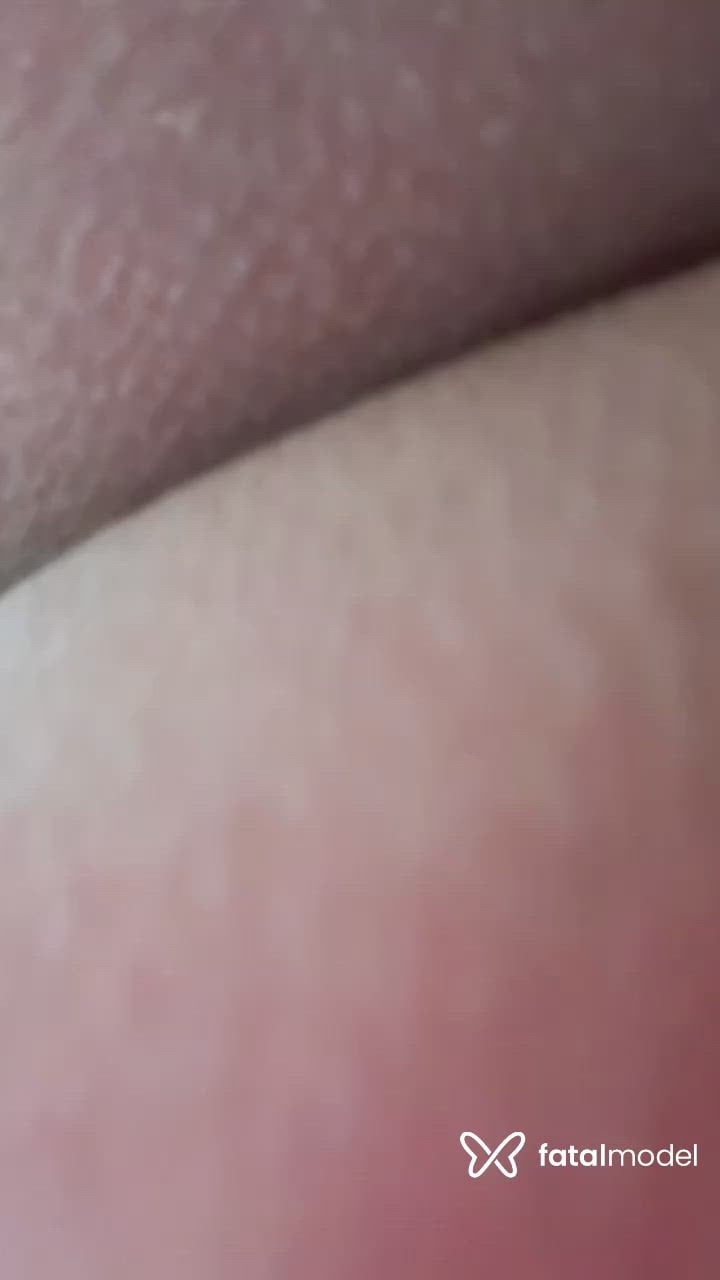 Vídeo 2