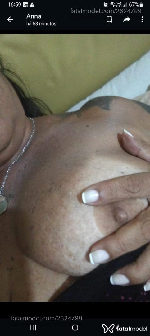 Imagem 5