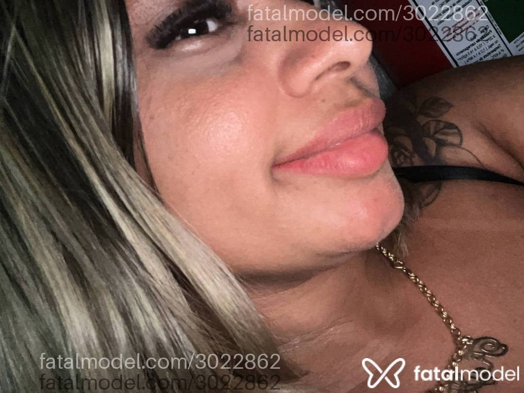 Imagem 3