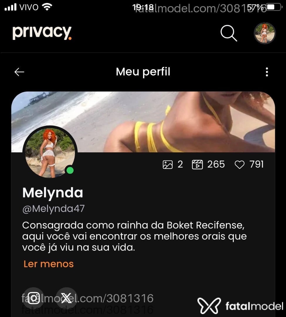 Acompanhante mulher trans ruiva (o) de olhos castanhos em Recife Acompanhante mulher trans ruiva (o) de olhos castanhos em Recife - Melynda