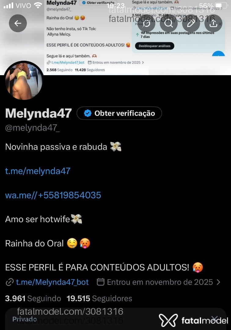 Acompanhante mulher trans ruiva (o) de olhos castanhos em Recife Acompanhante mulher trans ruiva (o) de olhos castanhos em Recife - Melynda